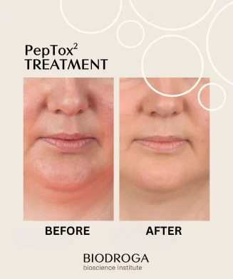 BI70275_Skin_Rejuvenating_Maske_FSCH1